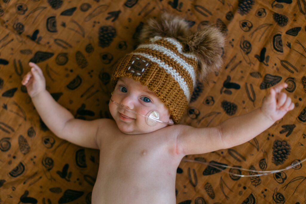 three month baby boy with breathing canula smiling during a milestone session in a natural lit coeur d'alene idaho studio 